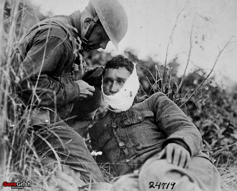 ww1-wounded-us-soldier.jpg
