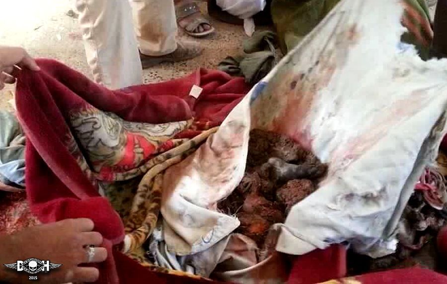 yemini-casualties-saudi-led-coalition-2-Yemen-2015.jpg