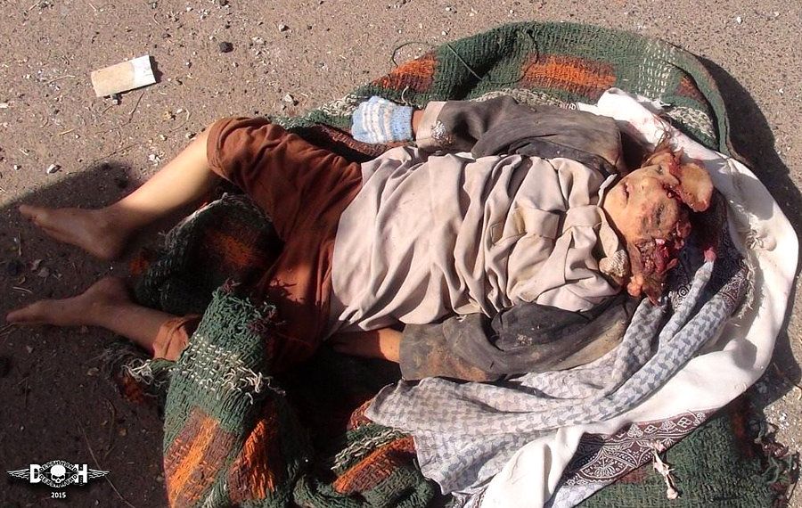 yemini-casualties-saudi-led-coalition-20-Yemen-2015.jpg