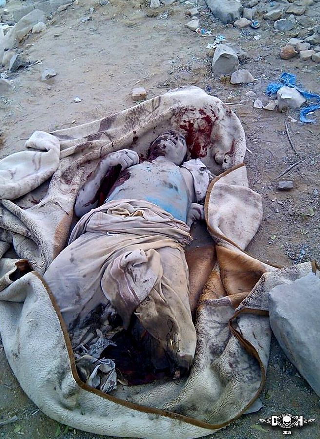 yemini-casualties-saudi-led-coalition-32-Yemen-2015.jpg