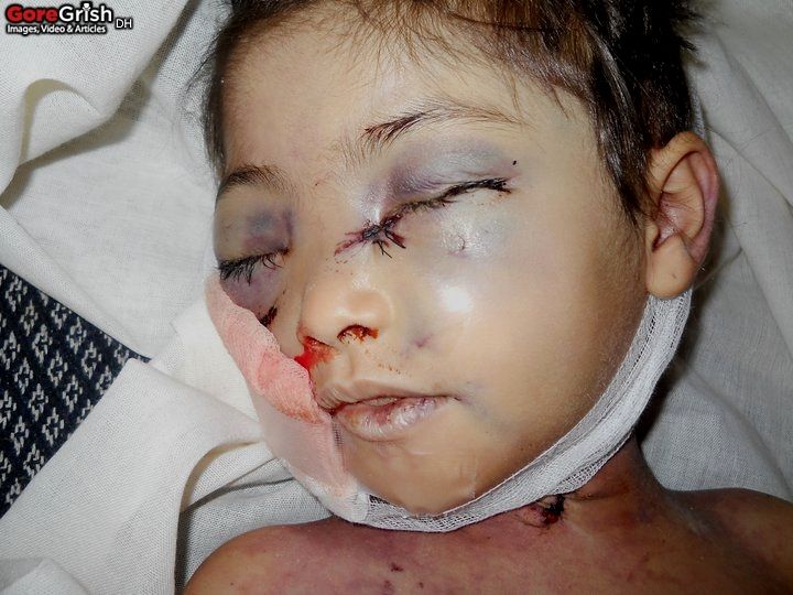 young-shooting-victim2-Yemen-may2011.jpg