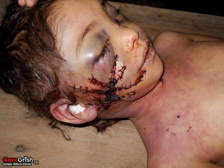 young-shooting-victim3-Yemen-may2011.jpg