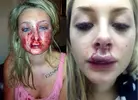 bite2.webp