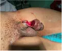 penis cut off.webp