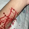 schizogangrape