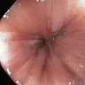Anal Anus