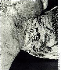 autopsy-showing-stab-wounds.jpg