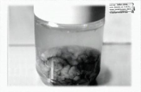 jeffrey-dahmer-brain-1.jpg