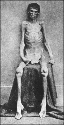 andersonville-prisoner.jpg