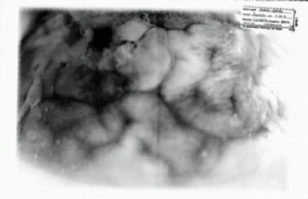 jeffrey-dahmer-brain-2.jpg
