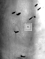 2-George-Anson%27s-wounds.jpg