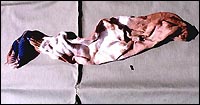 robins_bloody_sock.jpg