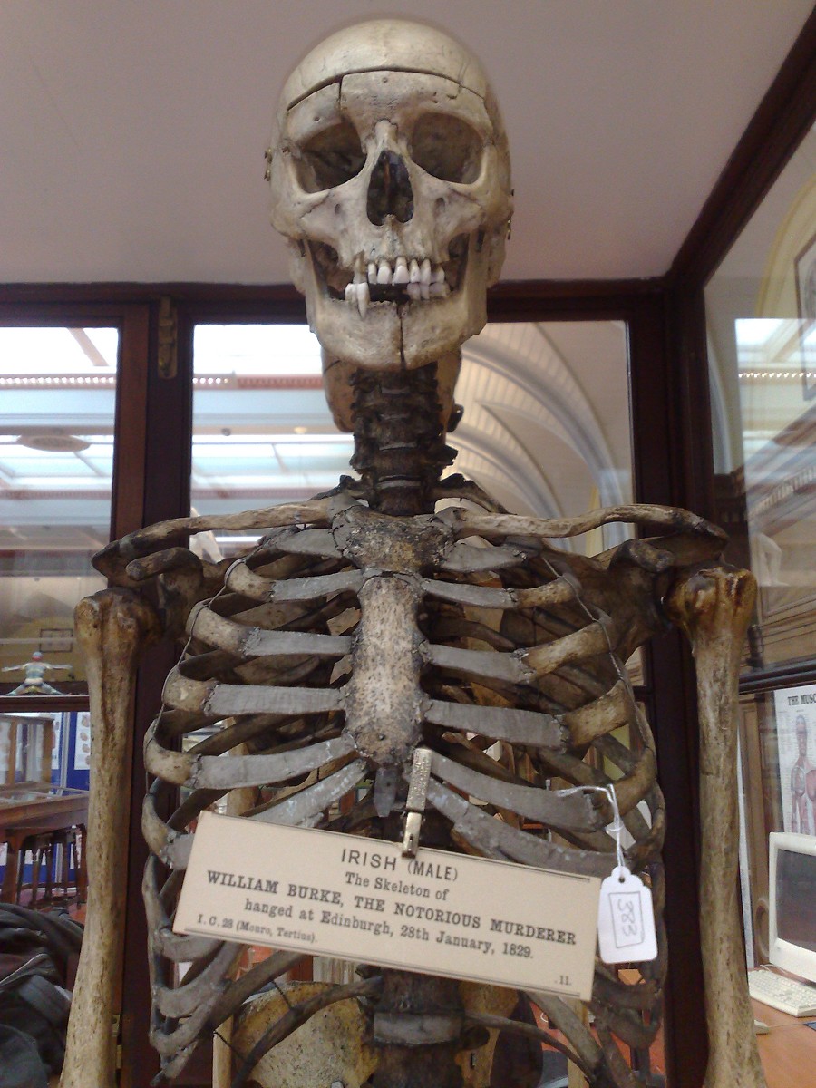 skeleton_002.jpg