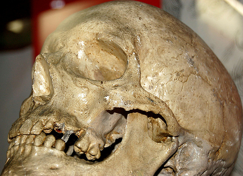 schenk-skull-1.jpg