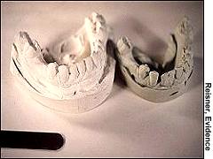 Compare-Smith%27s-teeth.jpg